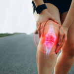 Schmerzgel Arthrose